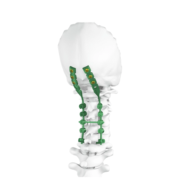 Sistema de tornillos para columna occipitocervical posterior
