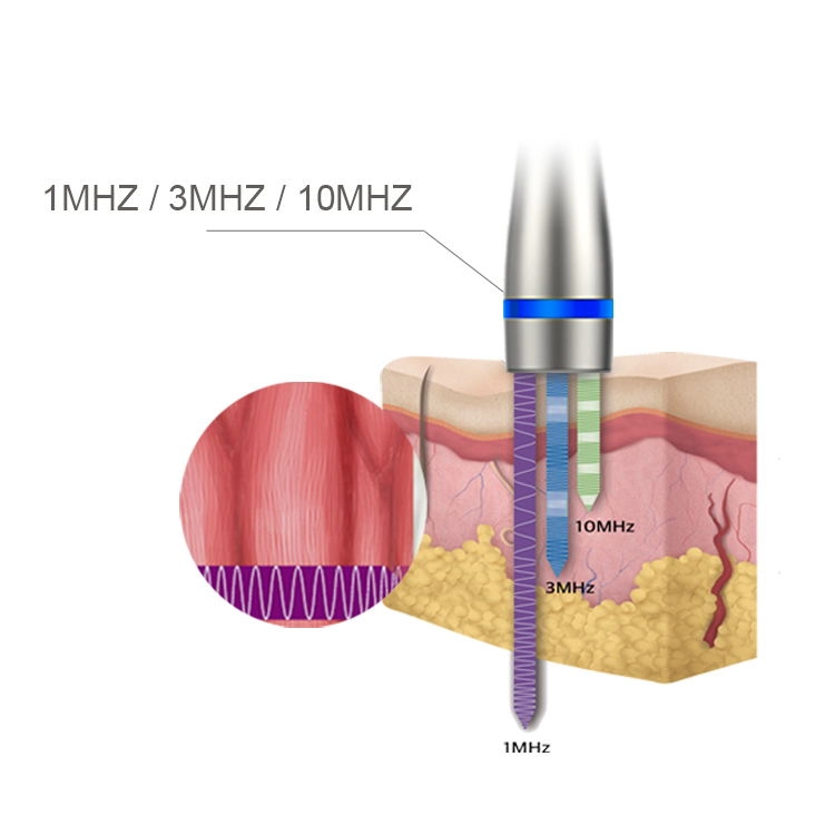 LDM Noblesse 10MHz Terapia de ultrasonido 3 en 1 Eliminación de arrugas ultrasónica Dispositivo de adelgazamiento de belleza Instrumento de cuidado facial